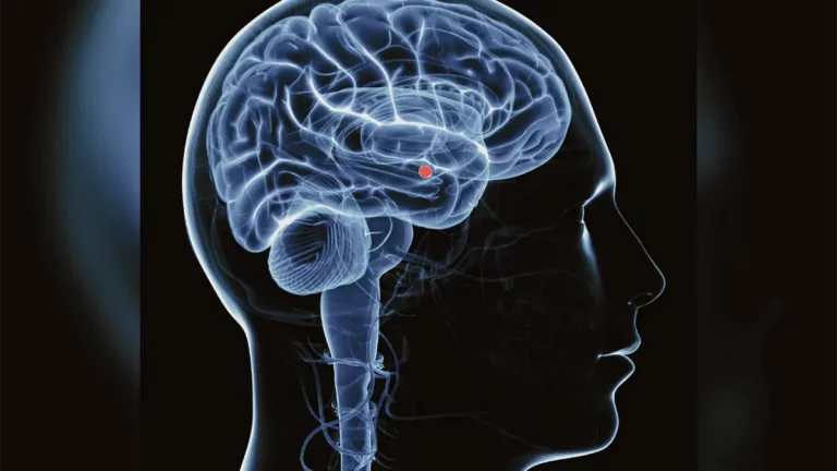 Agresión sexual afecta el cerebro con estrés postraumático