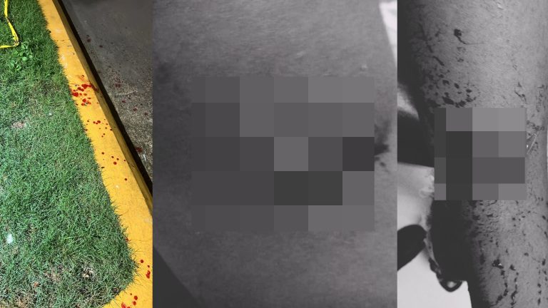 Pelea entre dos damas de acompañamiento deja heridas en Batey Sosúa