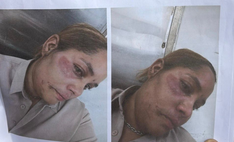Mujer denuncia que raso de la PN la agredió brutalmente y orden de arresto no ha sido ejecutada