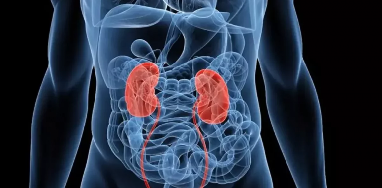 OMS emite alerta por falsificación de medicamento usado en trasplantados de riñón