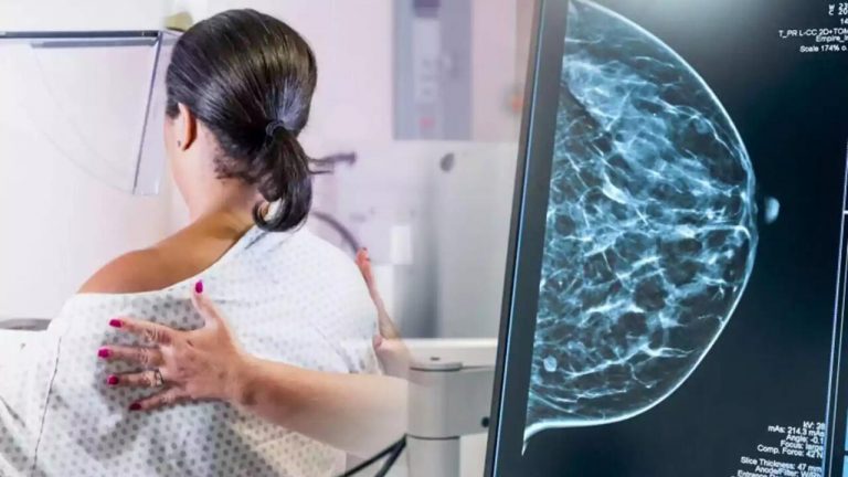 La IA ayuda a médicos a detectar el cáncer de mama en los cribados