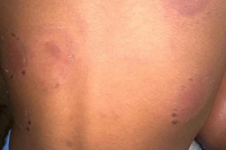 Madre denuncia presunto incidente con su hijo en centro educativo de Sosúa