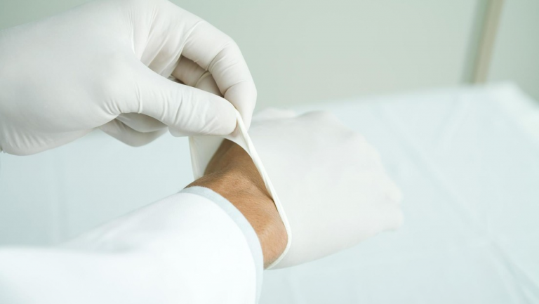 Se explotó un grano en la cara y tuvo que ser hospitalizada