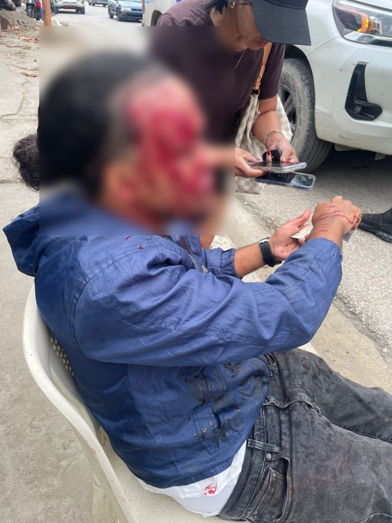 Joven resulta herido tras accidente en Cabarete este viernes en la tarde