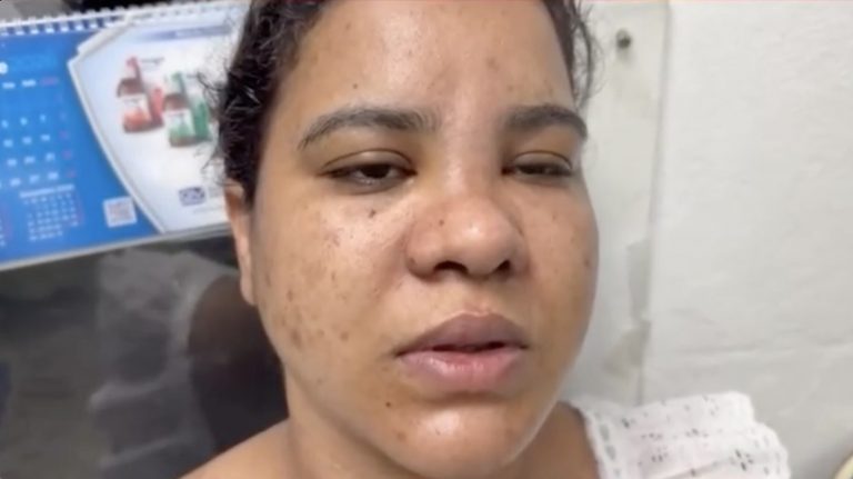 Brutal agresión en Moca: joven relata el ataque mientras permanece en estado crítico