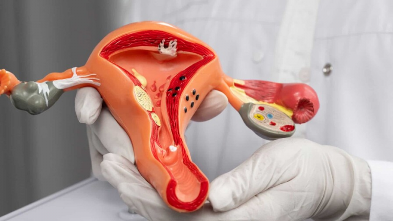 Cáncer de cérvix sigue entre los más frecuentes en RD: 110 casos en el Incart en 2025