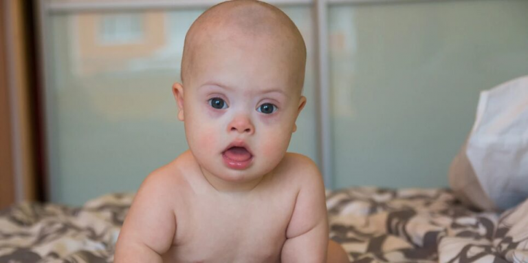 Describen cómo el síndrome de Down altera el desarrollo del cerebro antes de nacer