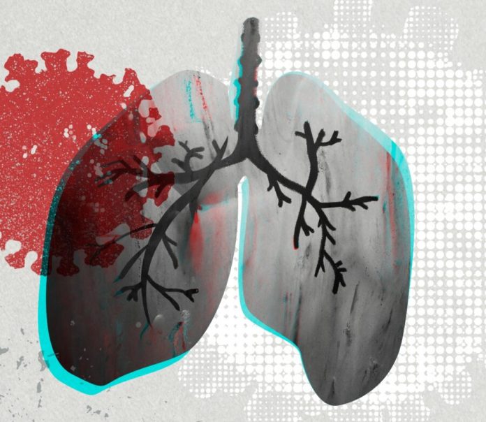 Lungs infected with coronavirus background